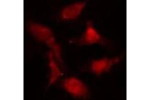 ABIN6274986 staining  Hela cells by IF/ICC. (CEP290 抗体  (Internal Region))