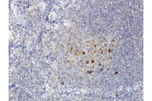 Immunoperoxidase of monoclonal antibody to ADAMDEC1 on formalin-fixed paraffin-embedded human tonsil. (ADAMDEC1 抗体  (AA 361-470))