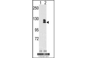 Western blot analysis of EphB2 using rabbit polyclonal EphB2 Antibody. (EPH Receptor B2 抗体)
