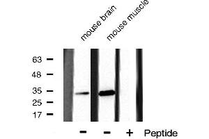 Western blot analysis of CDK5 phosphorylation expression in mouse brain and mouse muscle cell lysates,The lane on the right is treated with the antigen-specific peptide. (CDK5 抗体  (pTyr15))