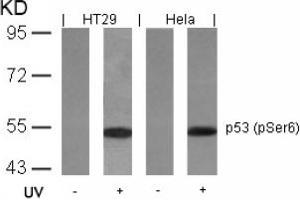 Image no. 2 for anti-Tumor Protein P53 (TP53) (pSer6) antibody (ABIN319211) (p53 抗体  (pSer6))