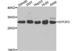 Western blot analysis of extracts of various cell lines, using GTF2F2 antibody.