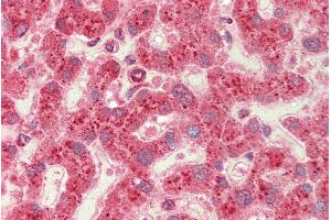 ABIN625820 (5µg/ml) staining of paraffin embedded Human Liver. (CROT 抗体  (C-Term))