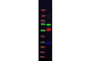 Western Blotting (WB) image for anti-serpin Peptidase Inhibitor, Clade A (Alpha-1 Antiproteinase, Antitrypsin), Member 1 (SERPINA1) antibody (ABIN107861)