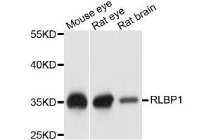 Western blot analysis of extracts of various cell lines, using RLBP1 antibody. (RLBP1 抗体  (AA 1-317))