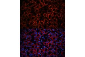 Immunofluorescence analysis of mouse kidney using Lipocalin-2/NGAL antibody (ABIN3017525, ABIN3017526, ABIN3017527 and ABIN6220135) at dilution of 1:100. (Lipocalin 2 抗体  (AA 1-100))