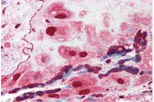 Human Placenta (formalin-fixed, paraffin-embedded) stained with ORAI3 antibody ABIN351441 at 3 ug/ml followed by biotinylated goat anti-rabbit IgG secondary antibody ABIN481713, alkaline phosphatase-streptavidin and chromogen. (ORAI3 抗体  (C-Term))