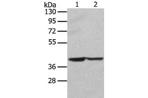 Western Blot analysis of Hela and hepg2 cell using STX16 Polyclonal Antibody at dilution of 1:400 (Syntaxin 16 抗体)