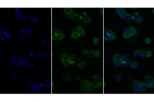 Detection of CD45 in Human Jurkat cell using Polyclonal Antibody to Protein Tyrosine Phosphatase Receptor Type C (CD45)