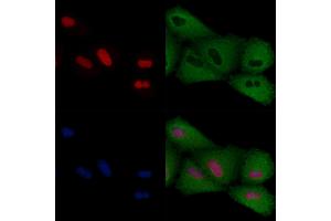 ABIN6259152 and ABIN6274301 staining  cells by IF/ICC.