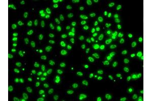 Immunofluorescence analysis of A549 cells using CSRNP1 antibody.