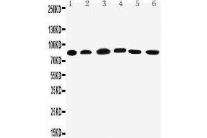 Western Blotting (WB) image for anti-Proprotein Convertase Subtilisin/kexin Type 1 (PCSK1) (AA 726-740), (C-Term) antibody (ABIN3044077)