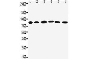 Anti-PC1/3 antibody, Western blotting Lane 1: Rat Liver Tissue Lysate Lane 2: Rat Thymus Tissue Lysate Lane 3: A549 Cell Lysate Lane 4: HELA Cell Lysate Lane 5: COLO320 Cell Lysate Lane 6: PANC Cell Lysate (PCSK1 抗体  (C-Term))