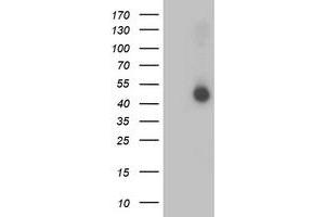 Western Blotting (WB) image for anti-Adaptor-Related Protein Complex 2, mu 1 Subunit (AP2M1) (AA 97-383) antibody (ABIN1491721) (AP2M1 抗体  (AA 97-383))