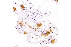 Immunohistochemistry of paraffin embedded rat lung using Calcitonin (ABIN7073271) at dilution of 1:700 (400x lens) (Calcitonin 抗体)