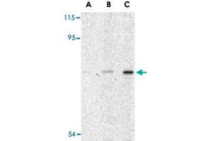 Western blot analysis of ATG7 in L1210 cell lysate with ATG7 polyclonal antibody  at (A) 1, (B) 2 and (C) 4 ug/mL . (ATG7 抗体  (N-Term))