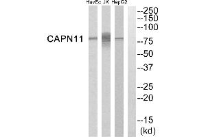 Western blot analysis of extracts from HepG2 cells, Jurkat cells and HuvEc cells, using CAPN11 antibody. (CAPN11 抗体)