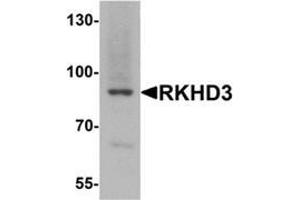 Western blot analysis of RKHD3 in mouse skeletal muscle tissue lysate with RKHD3 antibody at 1 ug/mL.