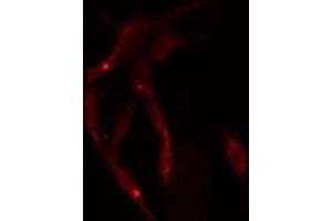 ABIN6275040 staining  NIH-3T3 cells by IF/ICC. (Superoxide dismutase copper chaperone 抗体  (C-Term))