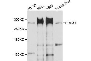 Western blot analysis of extracts of various cell lines, using BRCA1 antibody. (BRCA1 抗体  (AA 400-699))
