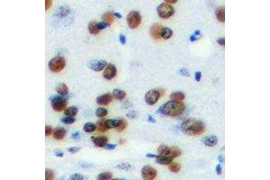 Immunohistochemical analysis of HMG-20A staining in mouse brain formalin fixed paraffin embedded tissue section. (HMG20A 抗体)