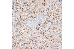 Immunohistochemistry of paraffin-embedded rat brain using GOT2 Rabbit mAb (ABIN7267427) at dilution of 1:100 (40x lens). (GOT2 抗体)