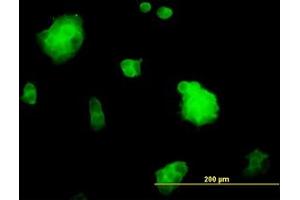 Image no. 4 for anti-Slingshot Homolog 3 (SSH3) (AA 293-392) antibody (ABIN599261) (SSH3 抗体  (AA 293-392))