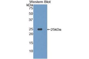 Western blot analysis of the recombinant protein. (TREM1 抗体  (AA 21-230))
