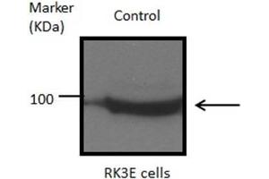 Western Blotting (WB) image for anti-Heat Shock Protein 90kDa alpha (Cytosolic), Class B Member 1 (HSP90AB1) (N-Term) antibody (ABIN2855047)