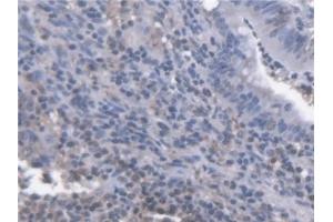 Immunohistochemistry (IHC) image for anti-Chemokine (C-X-C Motif) Ligand 14 (CXCL14) (AA 35-111) antibody (ABIN7433843)
