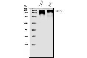 Western blot analysis of CD45/PTPRC using anti-CD45/PTPRC antibody (ABIN7599666).