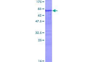 Image no. 1 for Carbonic Anhydrase IX (CA9) (AA 1-459) protein (GST tag) (ABIN1347791)