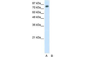 WB Suggested Anti-TSC22D2 Antibody Titration:  0. (TSC22D2 抗体  (N-Term))