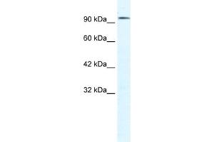 WB Suggested Anti-CLCN3 Antibody Titration:  1. (CLCN3 抗体  (C-Term))