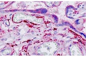 Immunohistochemistry (IHC) image for anti-rho/rac Guanine Nucleotide Exchange Factor (GEF) 2 (ARHGEF2) (AA 383-432) antibody (ABIN2879273)