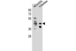 Western Blotting (WB) image for anti-Growth Hormone Secretagogue Receptor (GHSR) antibody (ABIN2996415) (GHSR 抗体)