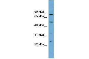 WB Suggested Anti-TFEB Antibody Titration: 0. (TFEB 抗体  (Middle Region))