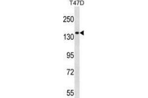 Western blot analysis in T47D cell line lysates (35ug/lane) using Myosin-Ie Antibody (N-term). (MYO1E 抗体  (N-Term))
