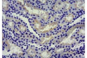 Immunohistochemistry (IHC) image for anti-Solute Carrier Family 5 (Sodium/glucose Cotransporter), Member 1 (SLC5A1) (Internal Region) antibody (ABIN870680)