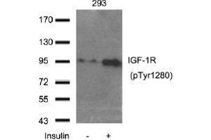 Western blot analysis of extract from 293 cells using IGF-1R (Phospho-Tyr1280). (IGF1R 抗体  (pTyr1280))