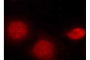 Immunofluorescence (IF) image for anti-Androgen Receptor (AR) (pSer213) antibody (ABIN3020082) (Androgen Receptor 抗体  (pSer213))