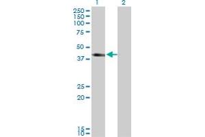 Western Blotting (WB) image for anti-Solute Carrier Family 12 (Sodium/potassium/chloride Transporters), Member 1 (SLC12A1) (AA 80-172) antibody (ABIN520255)