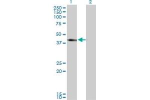 Western Blot analysis of SLC12A1 expression in transfected 293T cell line by SLC12A1 monoclonal antibody (M03), clone 4H4. (SLC12A1 抗体  (AA 80-172))
