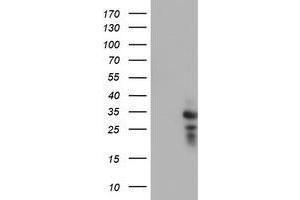 Western Blotting (WB) image for anti-Haloacid Dehalogenase-Like Hydrolase Domain Containing 1 (HDHD1) antibody (ABIN1498623) (HDHD1 抗体)