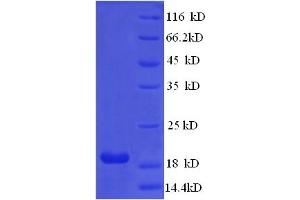 SDS-PAGE (SDS) image for Interferon, alpha 21 (IFNa21) (AA 24-189) protein (His tag) (ABIN5713532)