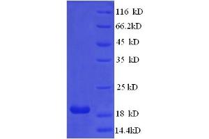 SDS-PAGE (SDS) image for Interferon, alpha 21 (IFNa21) (AA 24-189) protein (His tag) (ABIN5713532) (IFNA21 Protein (AA 24-189) (His tag))