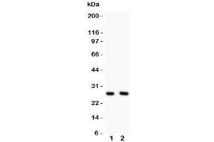 Western blot testing of Olig1 antibody and Lane 1:  U87;  2: HeLa lysate (OLIG1 抗体  (N-Term))