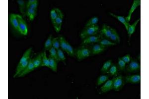 Immunofluorescent analysis of Hela cells using ABIN7144546 at dilution of 1:100 and Alexa Fluor 488-congugated AffiniPure Goat Anti-Rabbit IgG(H+L) (GIT1 抗体  (AA 470-642))
