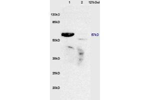 Lane 1: mouse lung lysates Lane 2: mouse brain lysates probed with Anti ROR Gamma/RORC/NR1F3 Polyclonal Antibody, Unconjugated (ABIN750298) at 1:200 in 4 °C. (RORC 抗体)