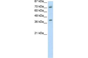Western Blotting (WB) image for anti-Zinc Finger Protein 282 (ZNF282) antibody (ABIN2461700) (ZNF282 抗体)